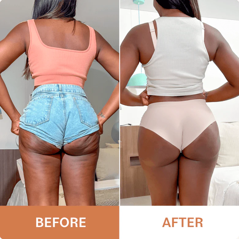 Crème liftante pour les fesses